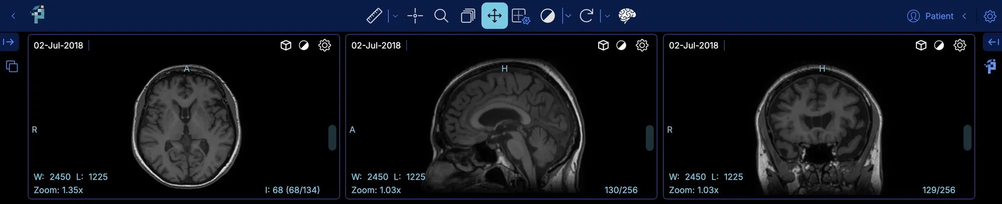 Brain MRI