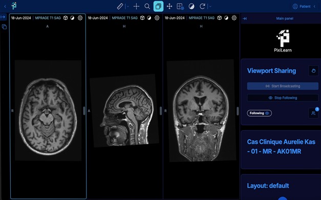 Brain T1 MRI open in the PixiLearn imaging viewer: axial, sagittal and coronal slices