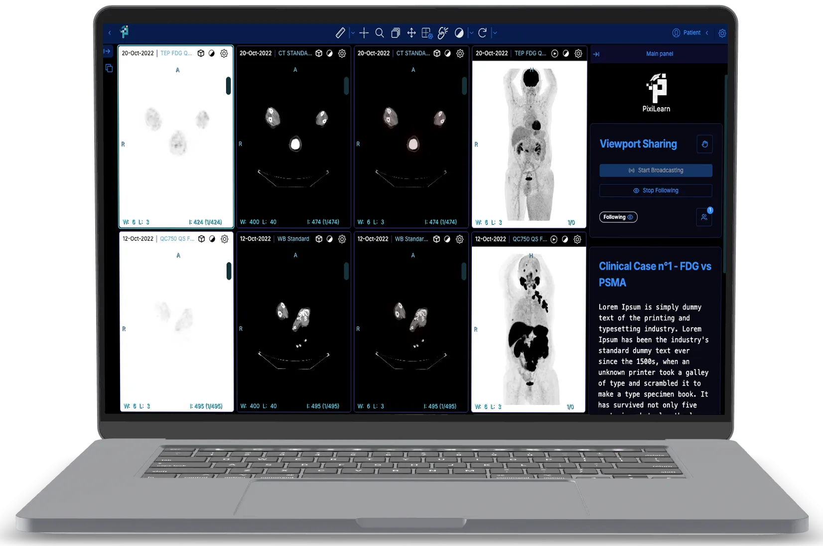 PixiLearn platform displaying a clinical case